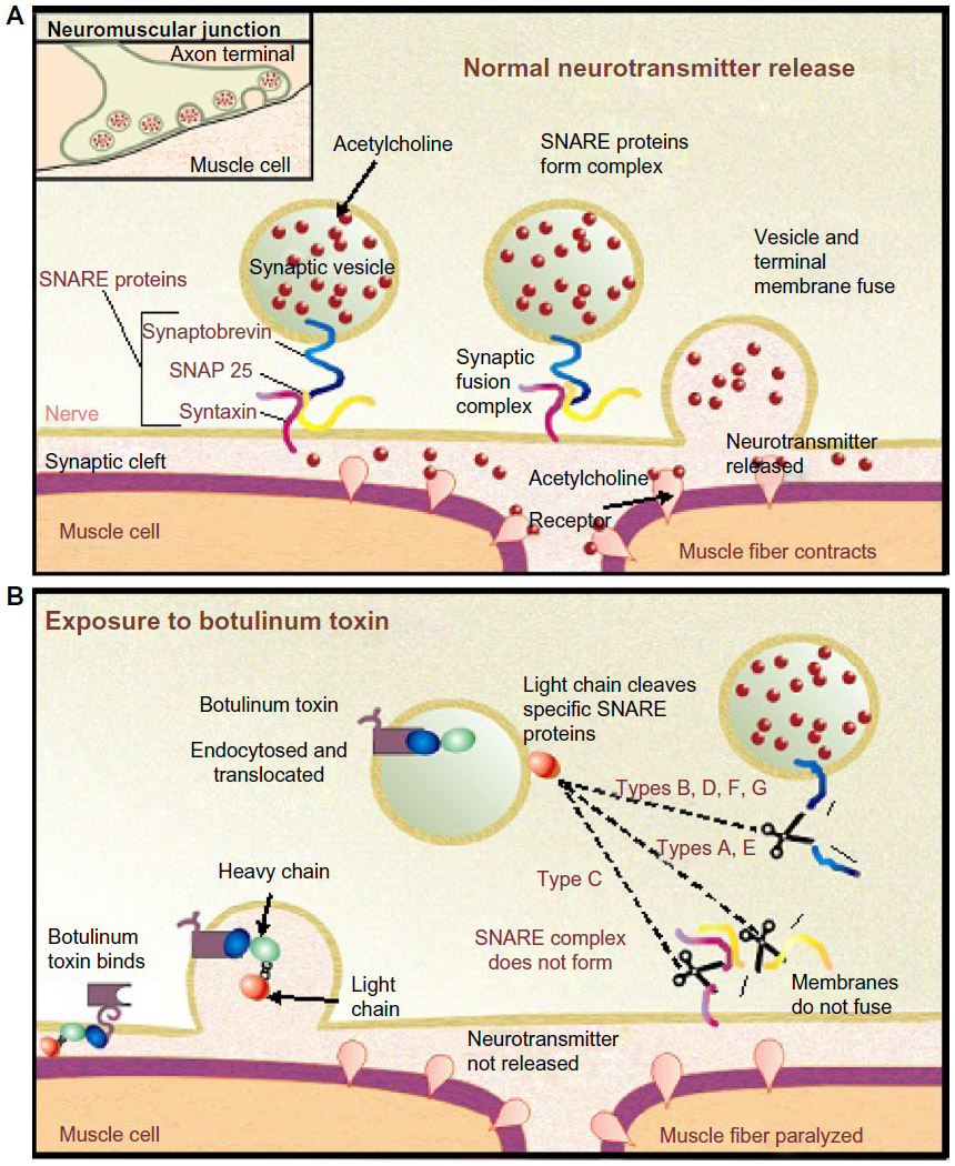 Mechanismus účinku botulotoxinu